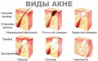 Жидкий корректор для лица