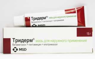 Кандидоз молочница у мужчины