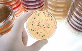 Streptococcus mitis 10 4 кое мл