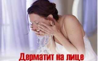 Чем вылечить дерматит на лице