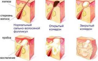 Очищение кожи лица в домашних условиях