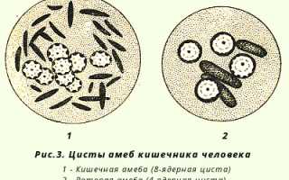 Как лечить кишечную амебу
