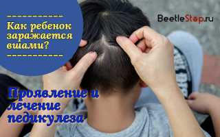Как быстро вывести вши у ребенка