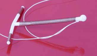 месячные после удаления спирали